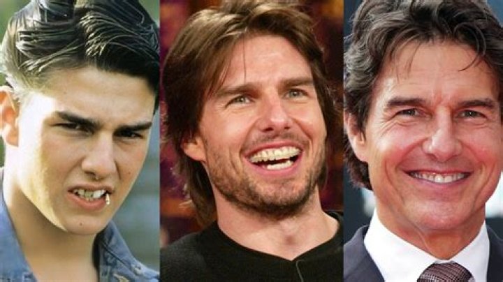 The weirdest things about Tom Cruise’s teeth and smile